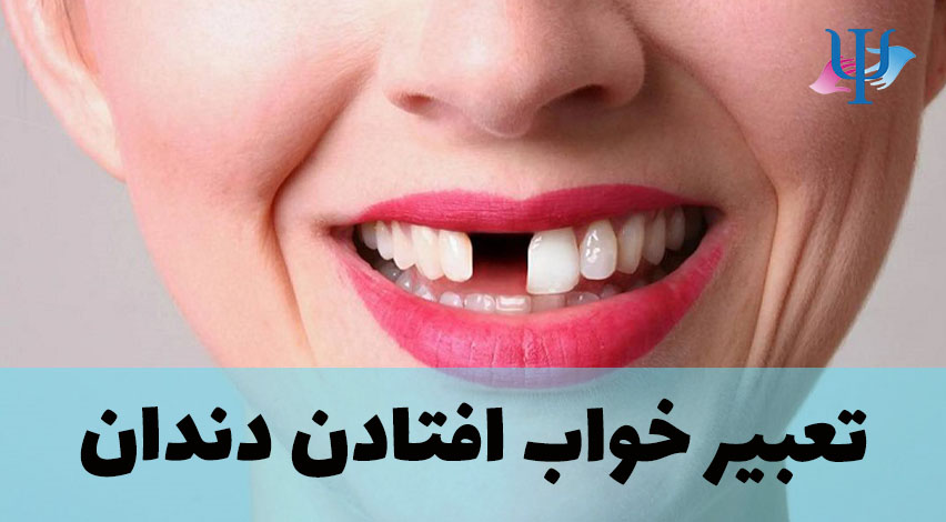 تعبیر خواب افتادن دندان